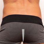 línea interglúeta hombre - depilación genital masculina