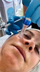 2x1 Limpieza facial Intense + Vitaminas - Imagen 7