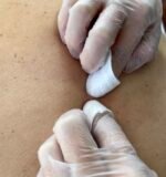 Limpieza Profunda Espalda - Imagen 2