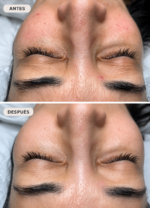 Limpieza Facial Korean Calm Skin - Imagen 2