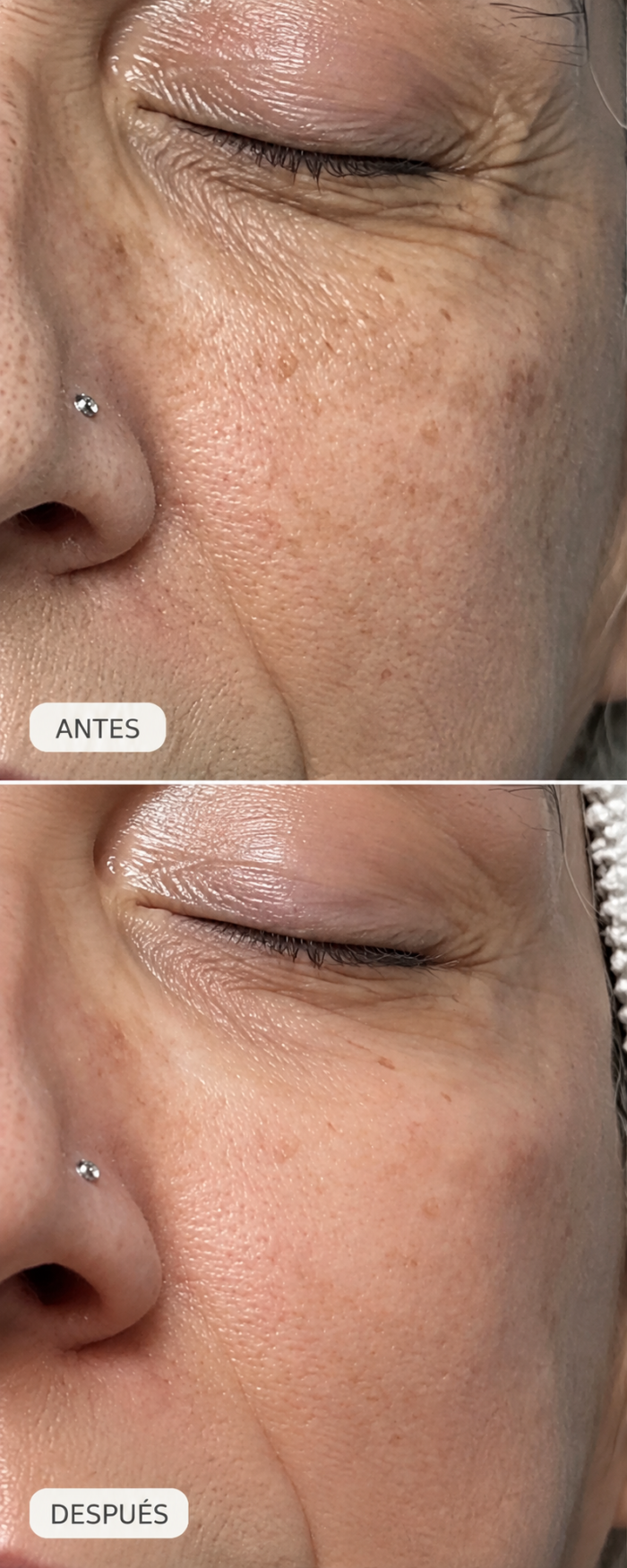 Limpieza Facial Korean Exosome Repair - Imagen 5