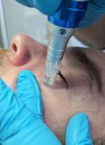 Limpieza Facial Korean Exosome Repair - Imagen 3