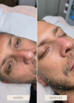 Limpieza Facial Korean Glass Skin - Imagen 2