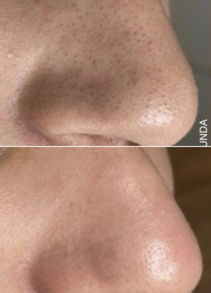 Limpieza Facial Korean Vitamin Glow - Imagen 2